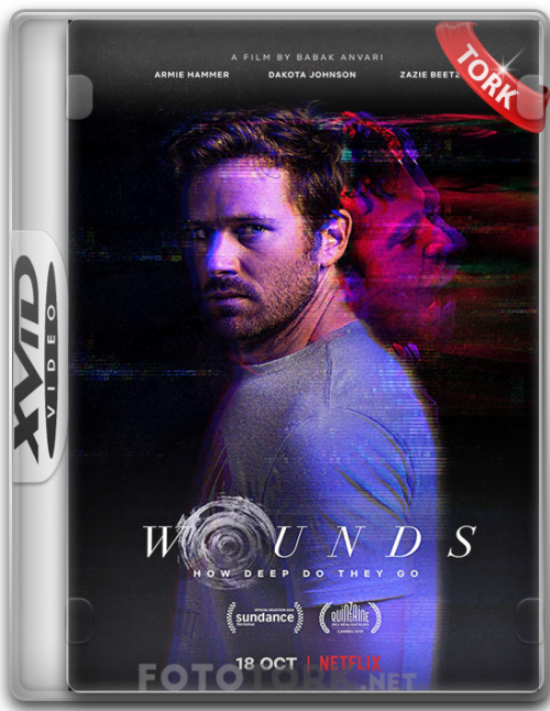 XvidWOUNDS.png